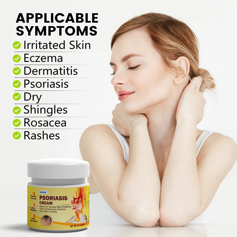 كريم علاج فطريات التينيا